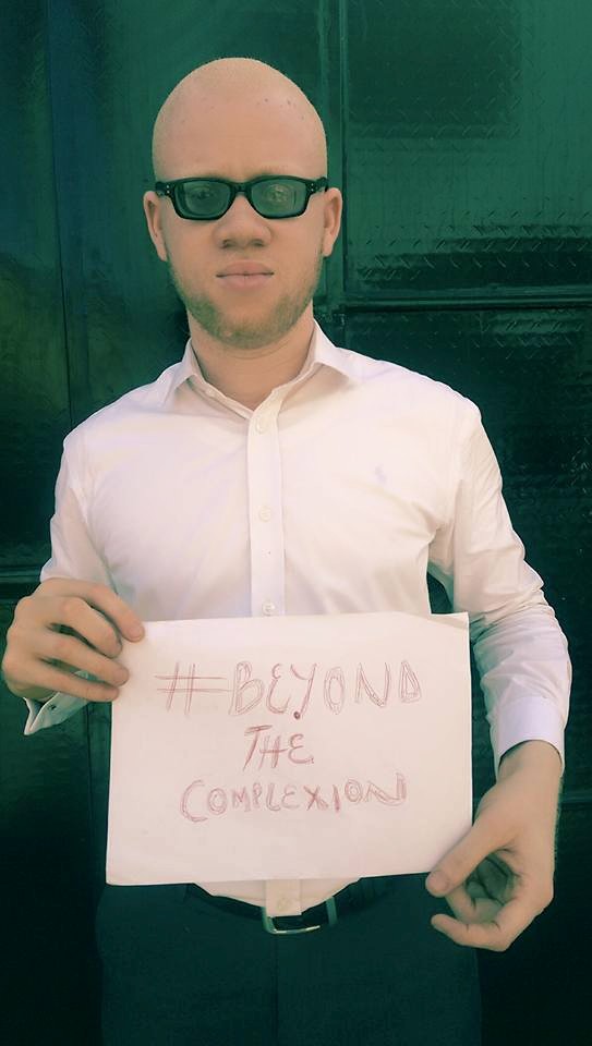 OAM Foundation, Onome Akinlolu Majaro Foundation,  Albino foundation in nigeria, #BeyondTtheComplexion