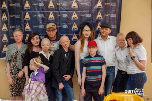 OAM Foundation, Onome Akinlolu Majaro Foundation, #BeyondTheComplexion, The Albino Foundation, TAF, Albinism & The Society, Albino, Albinism, Albino foundation, Albino foundation in nigeria