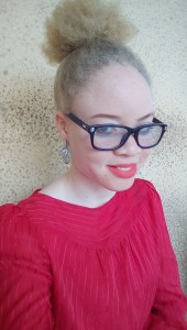 Eniola Alufa, OAM Foundation, #BeyondTheComplexion, Albinism, albino foundation in Nigeria, Onome Akinlolu Majaro Foundation