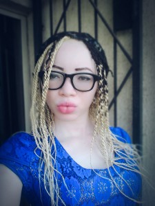 Chidiogo Sandra Anunandu, OAM Foundation, Albino Ffoundation, Albinism, Albino foundation in Nigeria, Onome Akinlolu Majaro Foundation, #BeyondTheComplexion