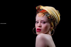 Anneline Mathiba, albino model, model with albinism, PWA, albino, albinism, #BeyondTheComplexion, OAM Foundation, Onome Akinlolu Majaro Foundation, albino foundation, albino foundation in Nigeria