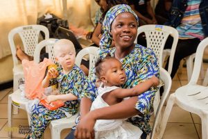#BeyondTheComplexion, OAM Foundation, Onome Akinlolu Majaro Foundation, International Albinism Awareness Day, Albino foundation, albinism, albino foundation in Nigeria, Nigerian albinos, Albinism in Nigeria, albino