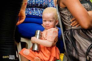 #BeyondTheComplexion, OAM Foundation, Onome Akinlolu Majaro Foundation, International Albinism Awareness Day, Albino foundation, albinism, albino foundation in Nigeria, Nigerian albinos, Albinism in Nigeria, albino