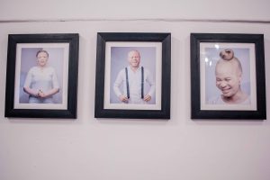 Angels Among Men, AAM, #BeyondTheComplexion, Albinism, Albino, Albino foundation, Albino foundation in Nigeria, OAM Foundation, Onome Akinlolu Majaro Foundation, Art exhibition, exhibition, art, Damilola Onafuwa